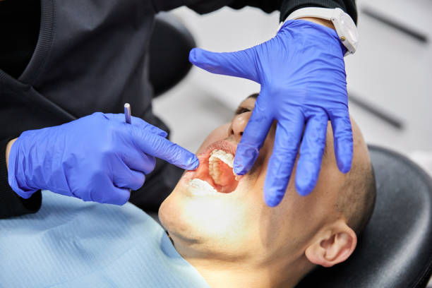 Best Chipped Tooth Repair Near Me  in Bridgetown, OH